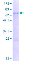 ab165484 on a 12.5% SDS-PAGE stained with Coomassie Blue.