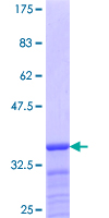 ab165485 on a 12.5% SDS-PAGE stained with Coomassie Blue.