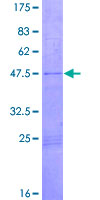 ab157854 on a 12.5% SDS-PAGE stained with Coomassie Blue.