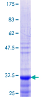 ab157855 on a 12.5% SDS-PAGE stained with Coomassie Blue.