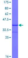 ab114647 analysed on a 12.5% SDS-PAGE gel stained with Coomassie Blue.