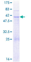 ab165389 on a 12.5% SDS-PAGE stained with Coomassie Blue.