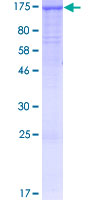 ab161579 on a 12.5% SDS-PAGE stained with Coomassie Blue.