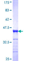 ab162231 on a 12.5% SDS-PAGE stained with Coomassie Blue.