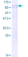 ab161695 on a 12.5% SDS-PAGE stained with Coomassie Blue.