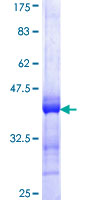 ab161696 on a 12.5% SDS-PAGE stained with Coomassie Blue.