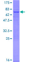 ab159046 on a 12.5% SDS-PAGE stained with Coomassie Blue.