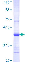 ab159047 on a 12.5% SDS-PAGE stained with Coomassie Blue.