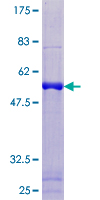 ab160157 on a 12.5% SDS-PAGE stained with Coomassie Blue.
