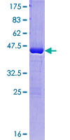 ab160520 on a 12.5% SDS-PAGE stained with Coomassie Blue.