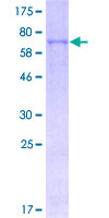 ab159048 on a 12.5% SDS-PAGE stained with Coomassie Blue.