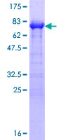 ab161063 on a 12.5% SDS-PAGE stained with Coomassie Blue.