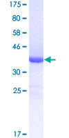 ab161064 on a 12.5% SDS-PAGE stained with Coomassie Blue.