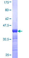 ab159049 on a 12.5% SDS-PAGE stained with Coomassie Blue.