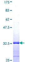 ab161506 on a 12.5% SDS-PAGE stained with Coomassie Blue.