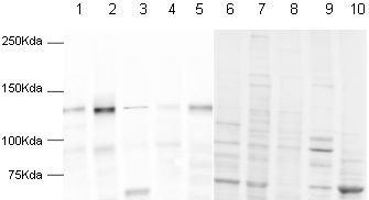 All lanes : Anti-pan Cadherin antibody - Plasma Membrane Marker ( ab16505 ) at 1 µg/ml Lane 1 : Mouse heart Lane 2 : HeLa cell lysate Lane 3 : 3T3 cell lysate Lane 4 : Mouse muscle Lane 5 : Human heart Lane 6 : Mouse heart with Human pan Cadherin peptide (ab17098) at 1 µg/ml Lane 7 : HeLa cell lysate with Human pan Cadherin peptide (ab17098) at 1 µg/ml Lane 8 : 3T3 cell lysate with Human pan Cadherin peptide (ab17098) at 1 µg/ml Lane 9 : Mouse muscle with Human pan Cadherin peptide (ab17098) at 1 µg/ml Lane 10 : Human heart with Human pan Cadherin peptide (ab17098) at 1 µg/ml Lysates/proteins at 20 µg per lane. Secondary Goat anti-rabbit conjugated to Alexafluor 680 at 1/10000 dilution Performed under reducing conditions. Predicted band size : 100 kDa Observed band size : 135 kDa ( why is the actual band size different from the predicted? )