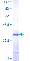 ab160718 on a 12.5% SDS-PAGE stained with Coomassie Blue.