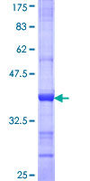 ab166056 on a 12.5% SDS-PAGE stained with Coomassie Blue.