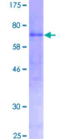 ab157887 on a 12.5% SDS-PAGE stained with Coomassie Blue.