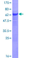 ab153362 on a 12.5% SDS-PAGE stained with Coomassie Blue.