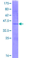 ab164188 on a 12.5% SDS-PAGE stained with Coomassie Blue.