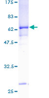 ab164061 on a 12.5% SDS-PAGE stained with Coomassie Blue.