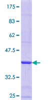 ab164062 on a 12.5% SDS-PAGE stained with Coomassie Blue.