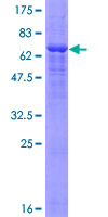 ab161770 on a 12.5% SDS-PAGE stained with Coomassie Blue.