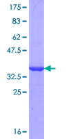 ab163389 on a 12.5% SDS-PAGE stained with Coomassie Blue.
