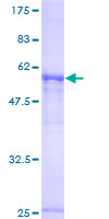 ab161197 on a 12.5% SDS-PAGE stained with Coomassie Blue.