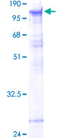 ab163420 on a 12.5% SDS-PAGE stained with Coomassie Blue.