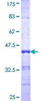 ab160320 on a 12.5% SDS-PAGE stained with Coomassie Blue.