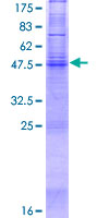 ab165651 on a 12.5% SDS-PAGE stained with Coomassie Blue.