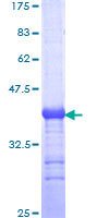 ab153324 on a 12.5% SDS-PAGE stained with Coomassie Blue.