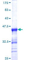 12.5% SDS-PAGE stained with Coomassie Blue.
