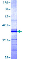 ab161538 on a 12.5% SDS-PAGE stained with Coomassie Blue.