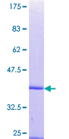 ab153419 on a 12.5% SDS-PAGE stained with Coomassie Blue.