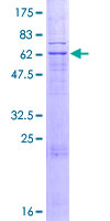 ab153398 on a 12.5% SDS-PAGE stained with Coomassie Blue.