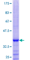 ab153399 on a 12.5% SDS-PAGE stained with Coomassie Blue.