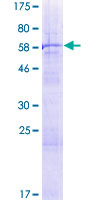 ab163478 on a 12.5% SDS-PAGE stained with Coomassie Blue.