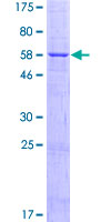 ab162911 on a 12.5% SDS-PAGE stained with Coomassie Blue.