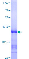 ab157860 on a 12.5% SDS-PAGE stained with Coomassie Blue.