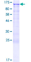 ab164069 on a 12.5% SDS-PAGE stained with Coomassie Blue.