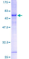 ab162234 on a 12.5% SDS-PAGE stained with Coomassie Blue.