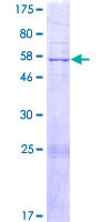 ab165722 on a 12.5% SDS-PAGE stained with Coomassie Blue.