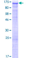 ab165430 on a 12.5% SDS-PAGE stained with Coomassie Blue.
