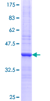 ab165431 on a 12.5% SDS-PAGE stained with Coomassie Blue.