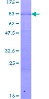 ab161706 on a 12.5% SDS-PAGE stained with Coomassie Blue.