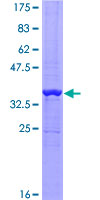 ab161707 on a 12.5% SDS-PAGE stained with Coomassie Blue.