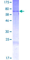 ab159050 on a 12.5% SDS-PAGE stained with Coomassie Blue.